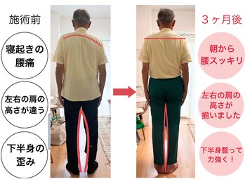 いろどり整体/【７０代男性】腰痛、猫背改善