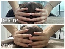 エクラニーク(Eclanique)/たった1回の施術でもしっかり