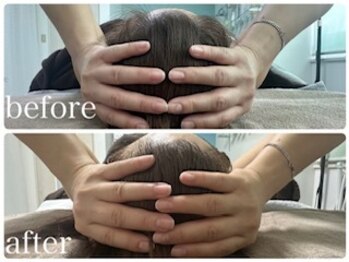 エクラニーク(Eclanique)/たった1回の施術でもしっかり