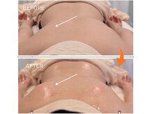 ミルアカ(Milu'aca)の雰囲気（コリを緩めて骨格を整えると、身体は軽くなる！）