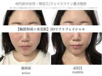 サボラミ(sabor A Mi)/継続により劇的変化します♪