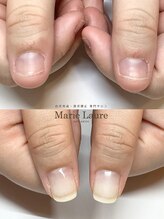 マリーロール 梅田店(Marie Laure)/自爪育成/深爪矯正/ネイルケア