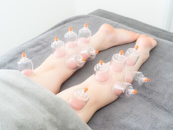 鍼グリッター 岡山本院(鍼Glitter.)/当日追加もOK☆人気の吸い玉