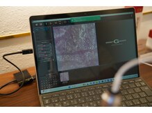 プラウド(Proud)/毛細血管診断/オプションで◎