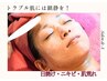 《トラブル肌》鎮静トリートメント
