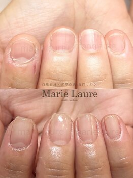 マリーロール 梅田店(Marie Laure)/深爪矯正/自爪育成/自爪風