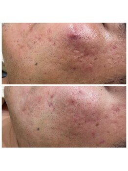 ガレリア エステ 名駅(GALLARIA)/根強いトラブルも急速鎮静!