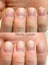 マリーロール 梅田店(Marie Laure)/深爪矯正/自爪育成/自爪風