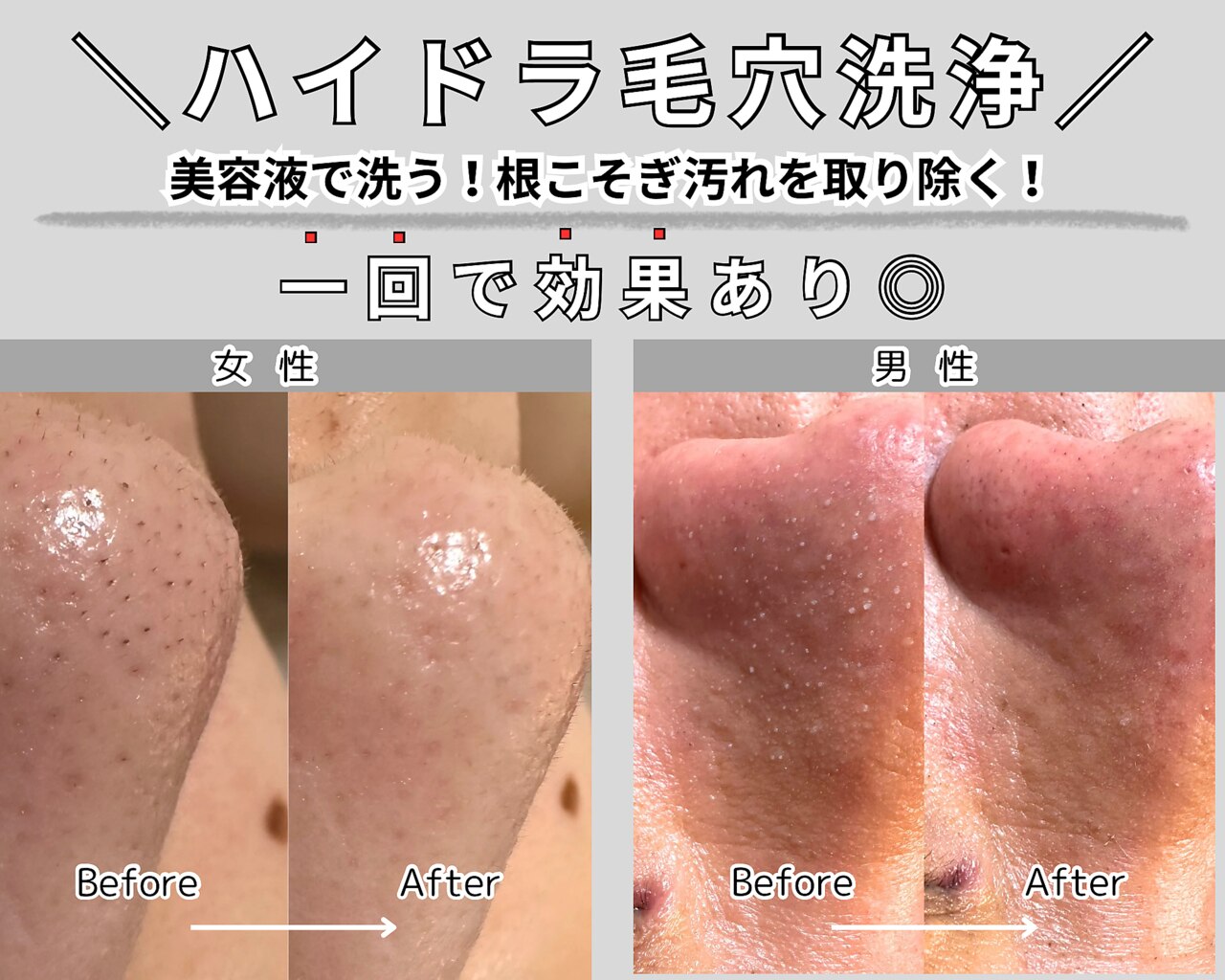 アーバンシック　メイクデビュー札幌＆百日草特別　現地的中単勝馬券セット m75365410540_1.jpg?1729408901