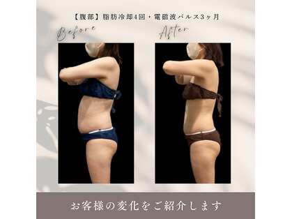 クールヴィラ(Cool Villa)の写真