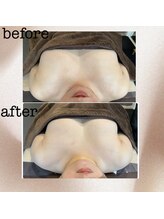 リリー(Lily)/ビフォーアフター