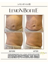 グラシーズ(Glasses)/レモンボトル