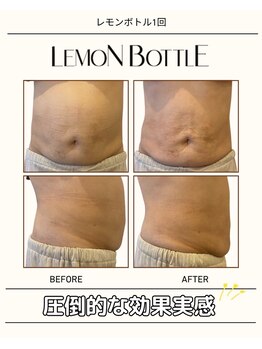 グラシーズ(Glasses)/レモンボトル