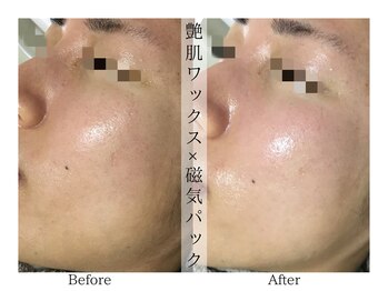 リララ(lelala)/磁気パックの魅力