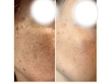 ソワンドゥース ヴェール(Soin douse Vert)/