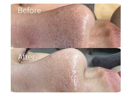 リッシュボーテ(RICHE BEAUTE)の写真