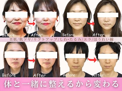 ワト(WATO)の写真