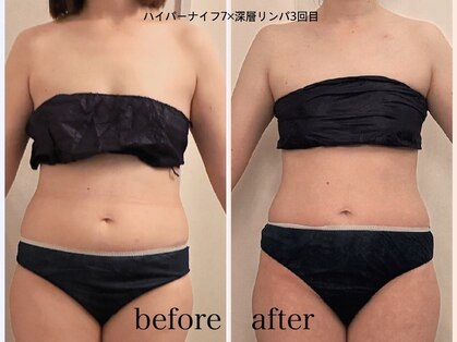 ナースのロミリンパの写真