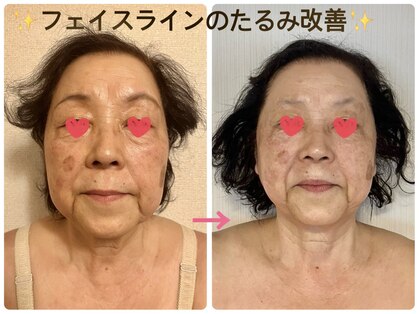 トルル(Tlulu)の写真