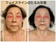 トルル(Tlulu)の写真