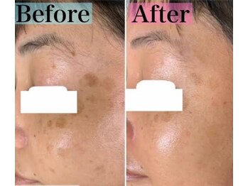 ドゥマイン(Do Mynd)/シミケア