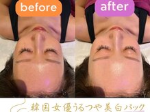 ドクターヴィー 高知(DrVi)/一度でしっかりうるツヤ美白♪