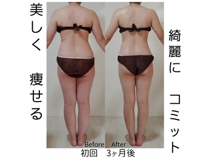 ラエッセス(A Laessess)の写真