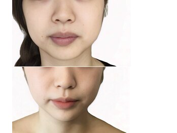 小顔美肌コルギ専門店 センティード 吉祥寺(Sentido)/