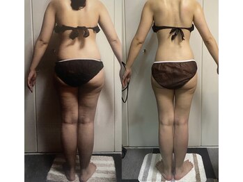 ロズアスール/★お客様の効果写真★