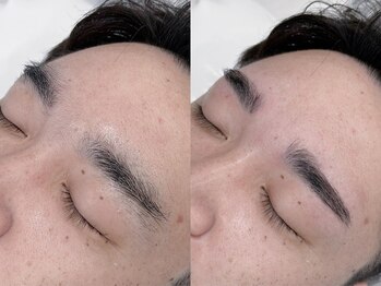 アッベリーレベッラ(A'bbellire Bella)/メンズハリウッドブロウリフト