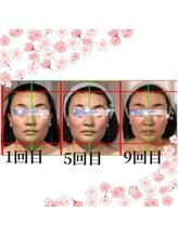 小顔整体研究所 KSラボ 新潟中山店/