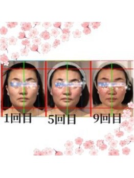 小顔整体研究所 KSラボ 新潟中山店/