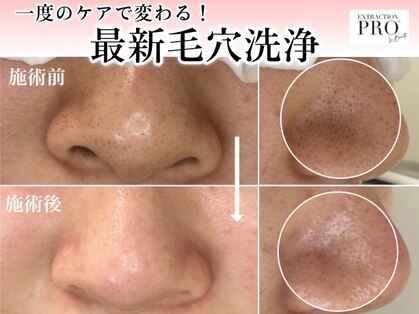 シルクナ(silkn)の写真