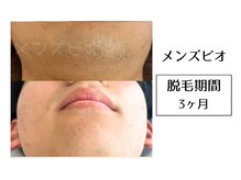 メンズビオ 神戸三宮店/