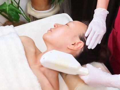 エピマルの写真