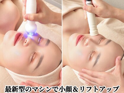 シリウス(Sirius)の写真