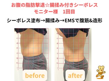 こつこつ接骨院 東麻布 赤羽橋/シーボレスモニター