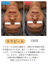 ユフラ(Juhla)/ララピール