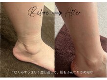 フロレゾン(Floraison)/悩ましげな脚のむくみ(*_*)冷え