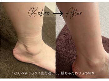 フロレゾン(Floraison)/悩ましげな脚のむくみ(*_*)冷え