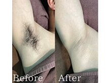 デェア コミータ