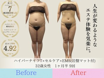 スワロウ(swallow)