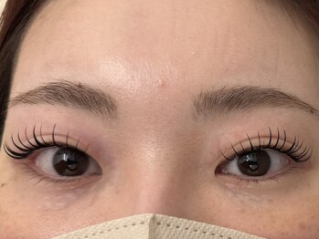 BBG 上野店/アンドヘルシー120本