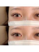 アイリス(eyeris)/フラットラッシュ