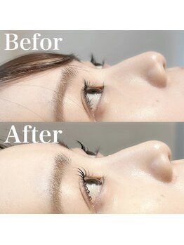 エメ 市川 本八幡(aimer)/まつ毛パーマ/ラッシュリフト