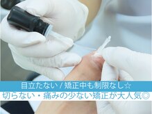 巻き爪補正店 秋葉原店の雰囲気（特許取得の補正器具を使用し、長年のお悩みを解消します☆/矯正）