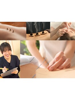 鍼灸施術を受けたい