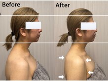 ベール(BEHL)/コルギのBefore After