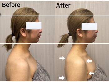ベール(BEHL)/コルギのBefore After