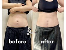 癒しのえんじゅ